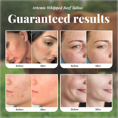 ARTEMIS Whipped Beef Tallow Natural Balm Face Cream, 6 oz (Pack of 1) | Moisturizer, Cream for Soft, Smooth Skin, Body Lotion, Skin Care, Lip Balm Organic, Tallow cream | Vitamins A, C, D, and E | Lavander Scent